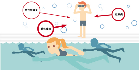 夏季當(dāng)心紅眼病，網(wǎng)吧泳池成高發(fā)區(qū)