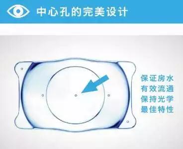 高度近視的“終結(jié)者”——ICL晶體植入術(shù)！