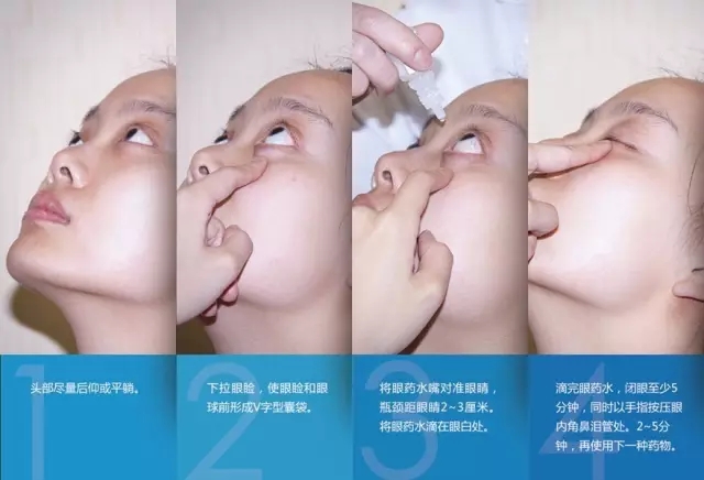 眼藥水你點(diǎn)對(duì)了嗎？快來(lái)看看！