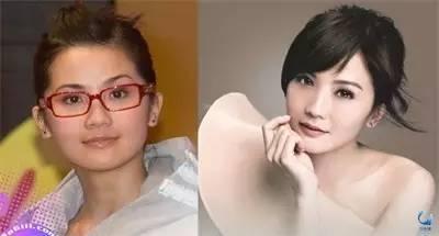 那些近視戴鏡暴丑的女明星們是做了什么變美了？？？